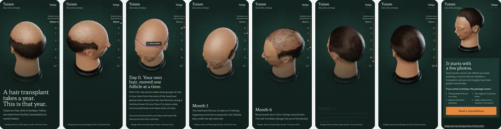 Eight phone screens from the clinic demo: the head before the procedure, the new hairline drawn on day zero, month one, month three, month six, month nine, month twelve, and the consultation form.