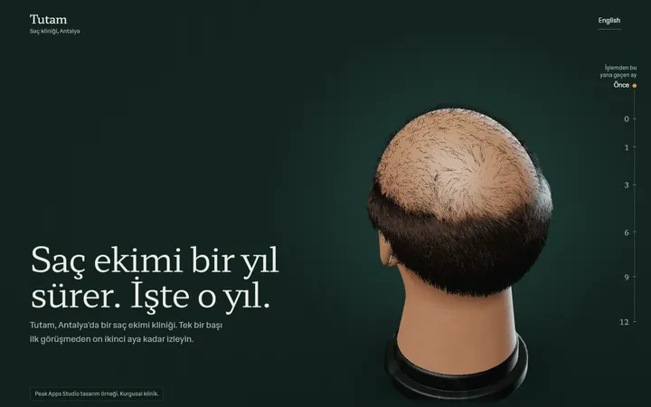 Klinik örneği dizüstü bilgisayarda: tepesi seyrelmiş 3D bir baş ve “Saç ekimi bir yıl sürer.” başlığı.
